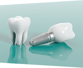 インプラントと組み合わせた入れ歯も提供